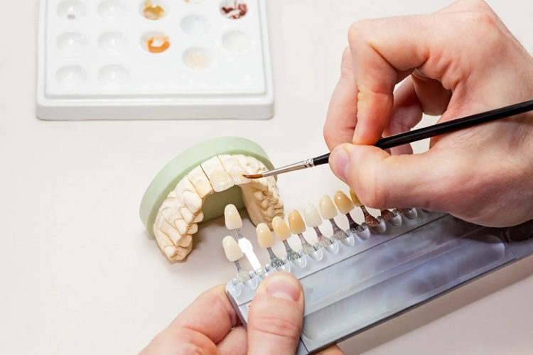 Giảm thất lạc mẫu Labo & đối soát chi phí: Giải pháp tiết kiệm và minh bạch cho phòng khám nha khoa
