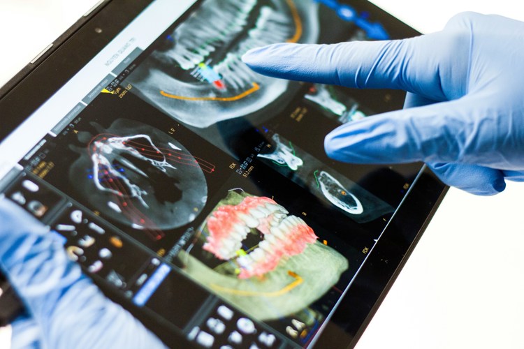  So sánh phần mềm nha khoa SimlyDent với DentalFlow 2026